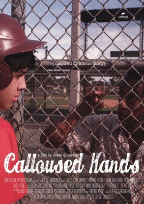 Calloused Hands Canvas Poster