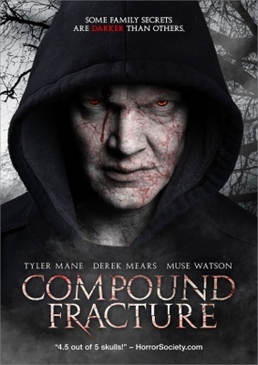 Compound Fracture Poster 1236116