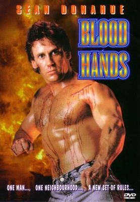 Blood Hands Metal Framed Poster