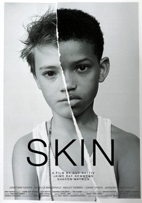 Skin Wooden Framed Poster