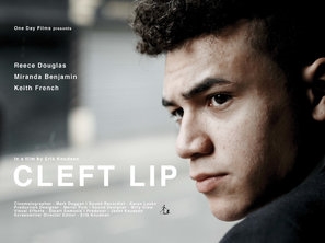 Cleft Lip Poster with Hanger